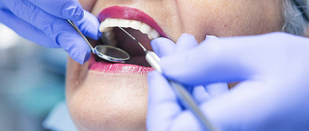 Best Emergency Tooth Extraction  in Burnham, PA